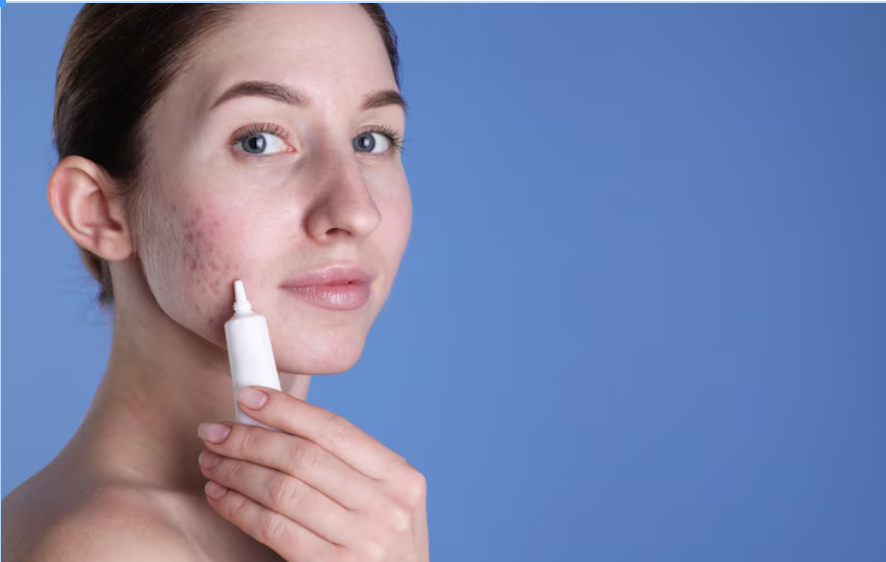 Gia công kem mụn thâm tác động kép, chi phí tối ưu